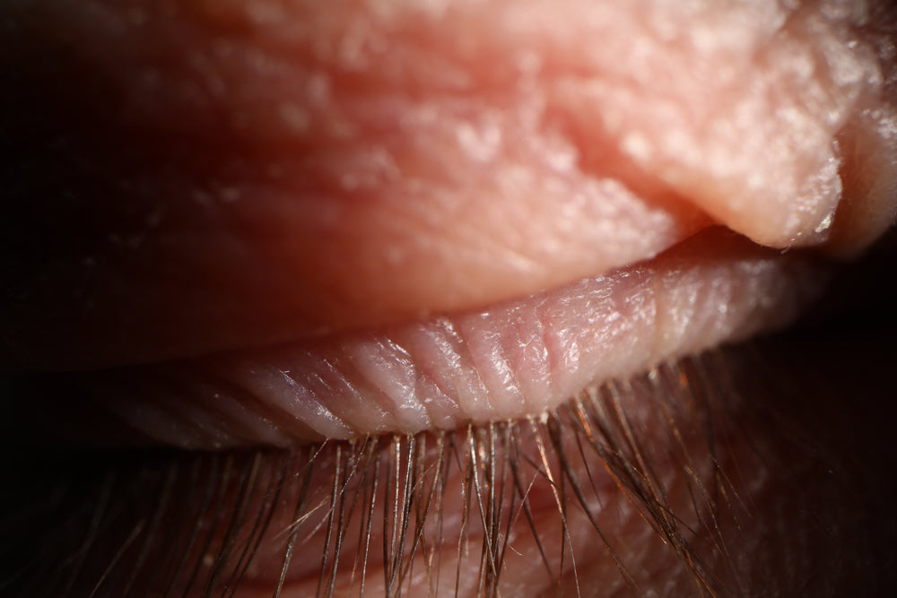 Person asleep in bed at dawn with the eyelids not fully closed and light across the face