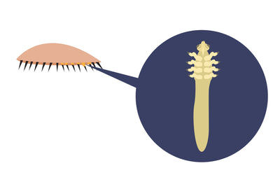 How to Get Rid of Demodex Mites on Your Eyelids