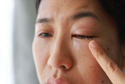 Does Castor Oil Kill Demodex Mites? What a 2025 University of Auckland Study Found